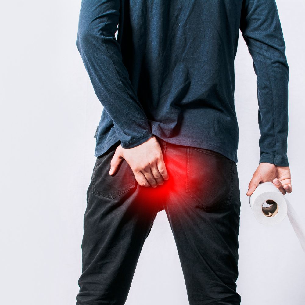 Hemorrhoids | Piles Supplements | Piles Treatment