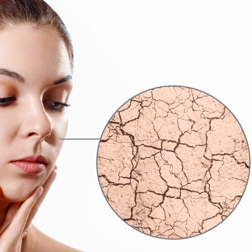 Dry Skin | Skin Care Treatment | Skin Care Products