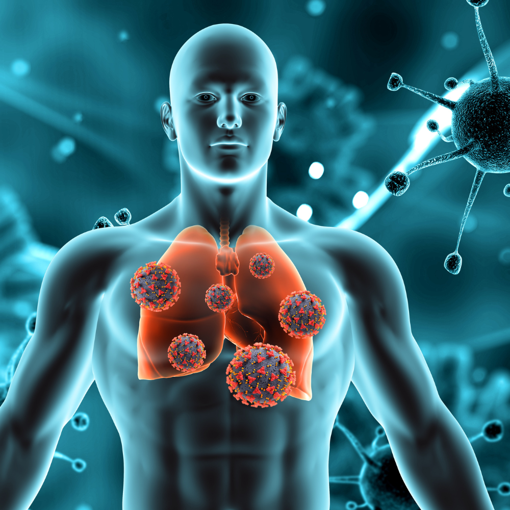 Tuberculosis (TB)  | Lung Health | Tuberculosis Treatment
