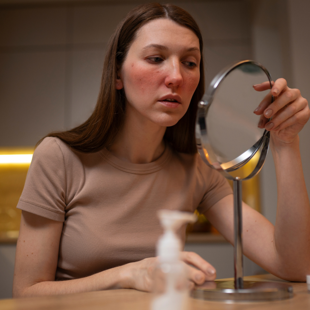 Common Skin Disorders Treatments | Skin Disorders Supplements