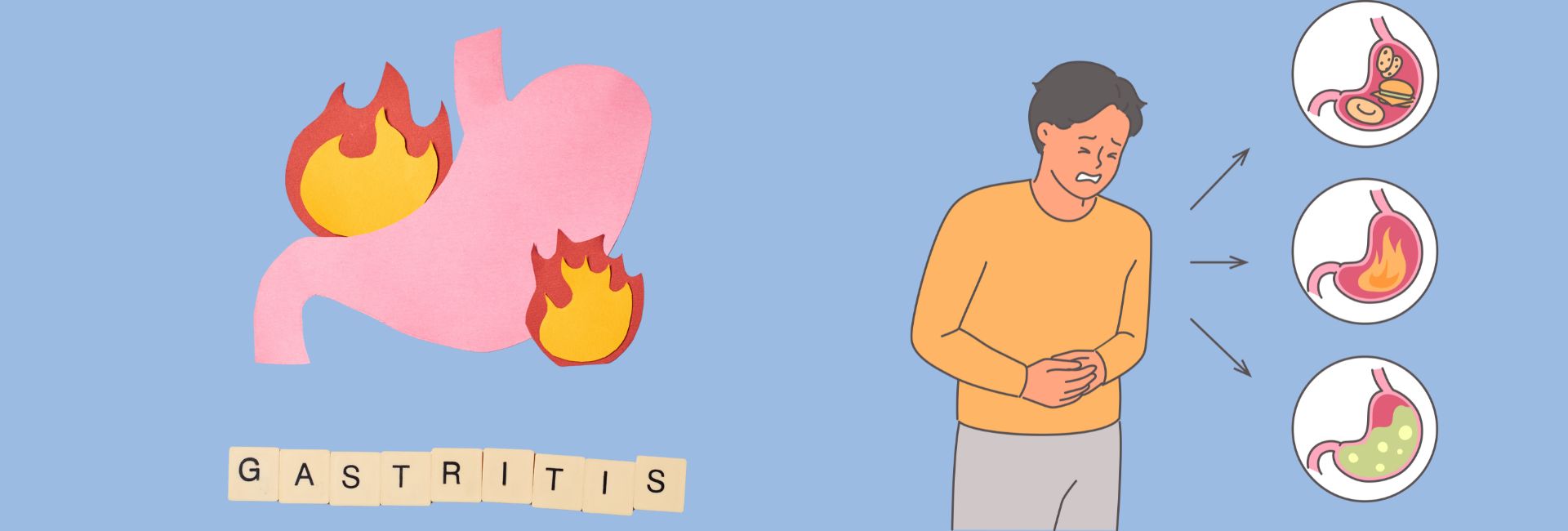 Amlapitta treatment in Ayurveda for gastritis and acidity