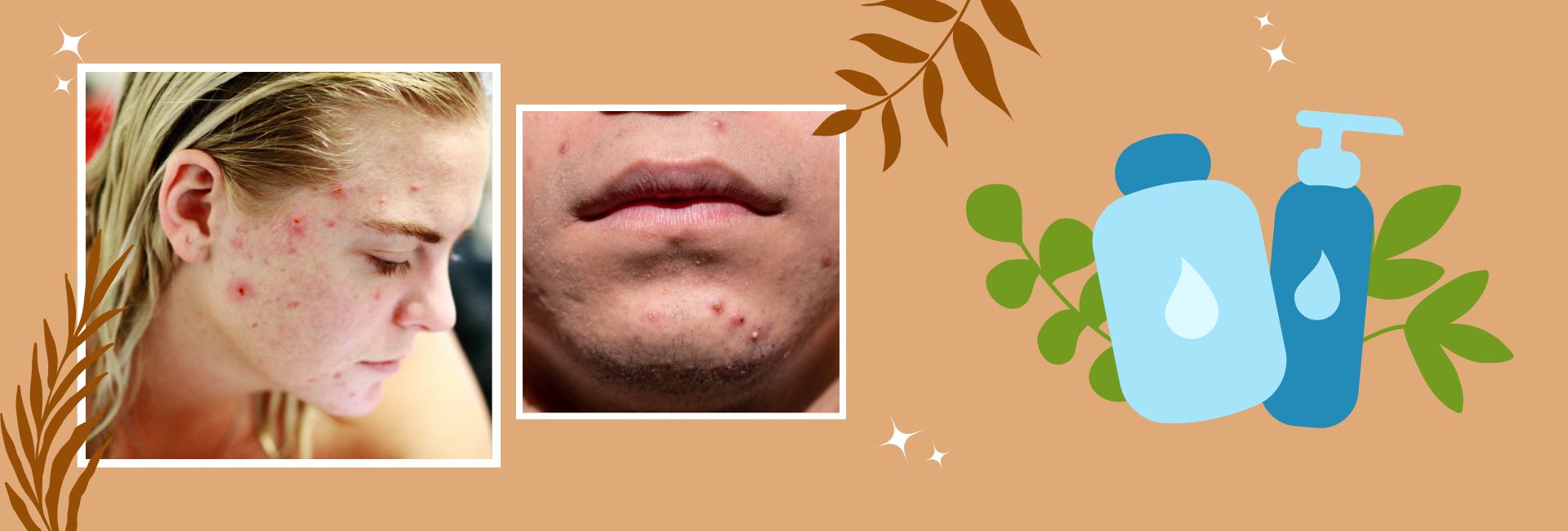 Natural remedies for common skin disorders including aloe vera, turmeric, honey, and Ayurvedic herbs for healthy glowing skin